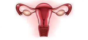 Fibroamele uterine