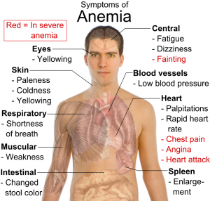 Anemia feripriva - simptome, tratament si prevenire | Bioclinica