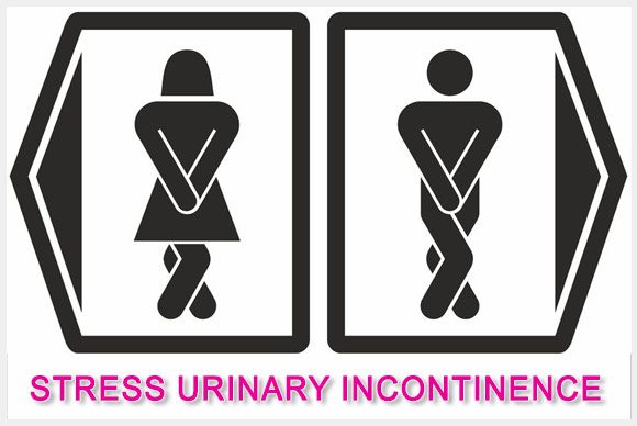 Incontinenta urinara