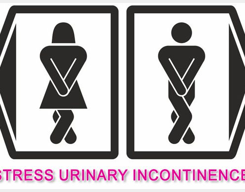 Incontinenta urinara