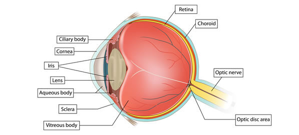 Cataracta