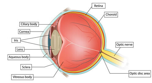 Cataracta